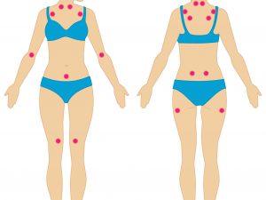 3912-what-fibromyalgia-symptoms-look-like-1296×1400-body