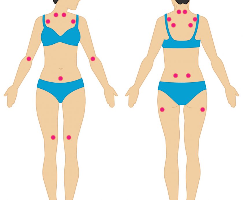 3912-what-fibromyalgia-symptoms-look-like-1296×1400-body