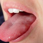 婦女疑難雜症，看似與婦科無關，竟是如此......感謝主！